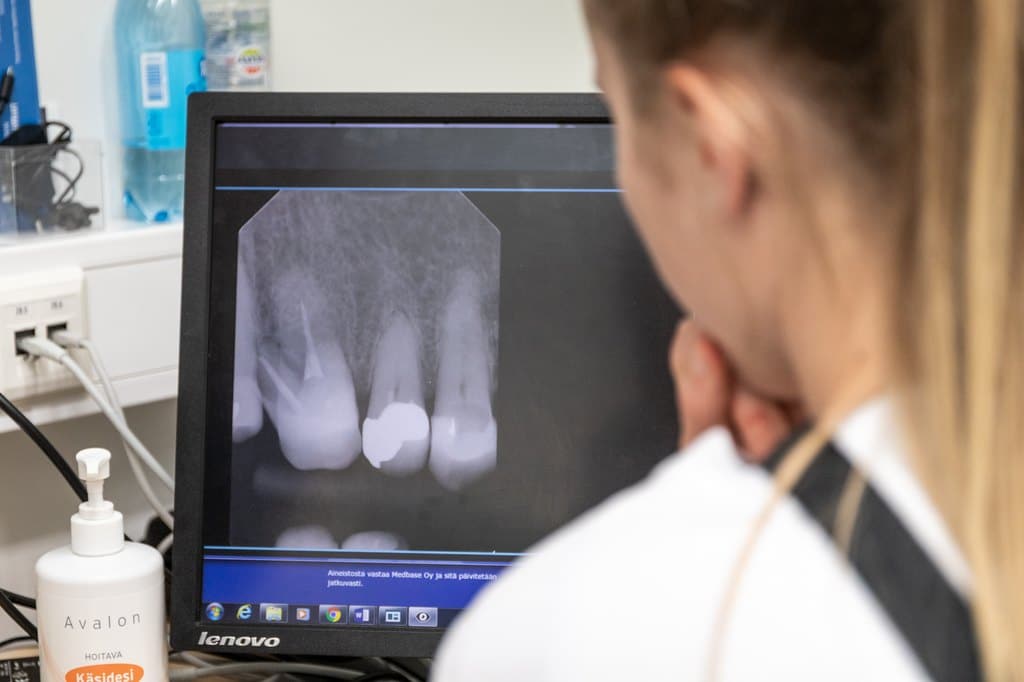 nainen katselee röntgenkuvaa hampaasta